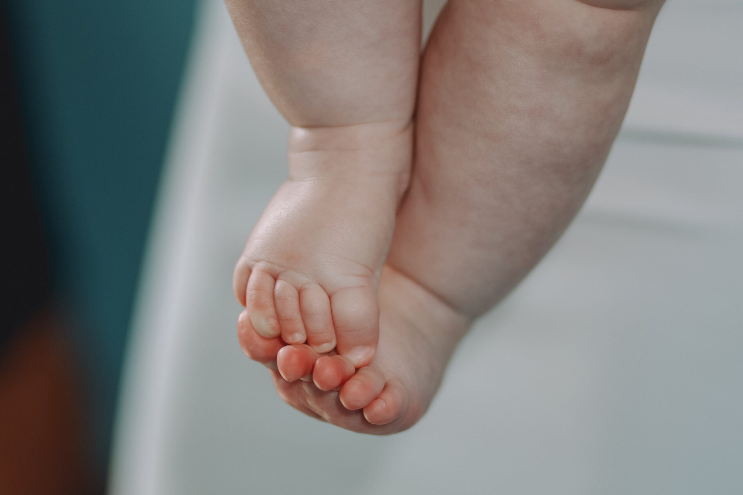 Mengatasi Dermatitis Atopik pada Anak: Peran Penting Pola Hidup dan Perawatan